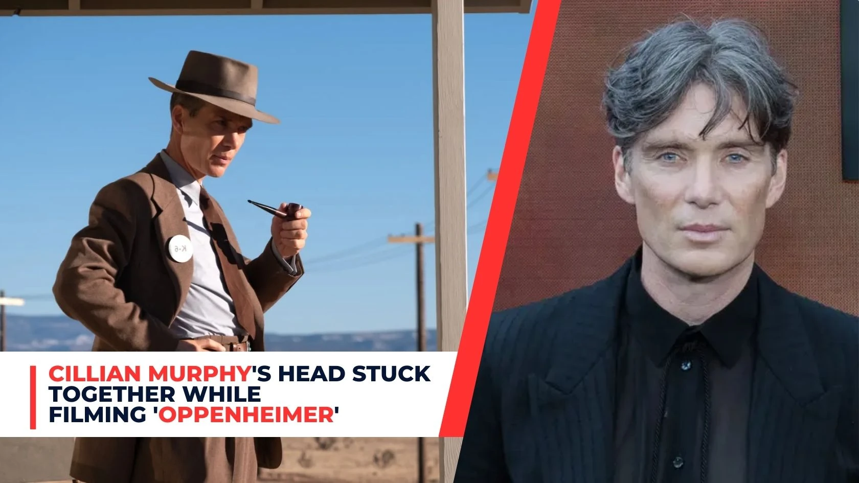 Cillian Murphy's Head Stuck Together While Filming 'Oppenheimer'